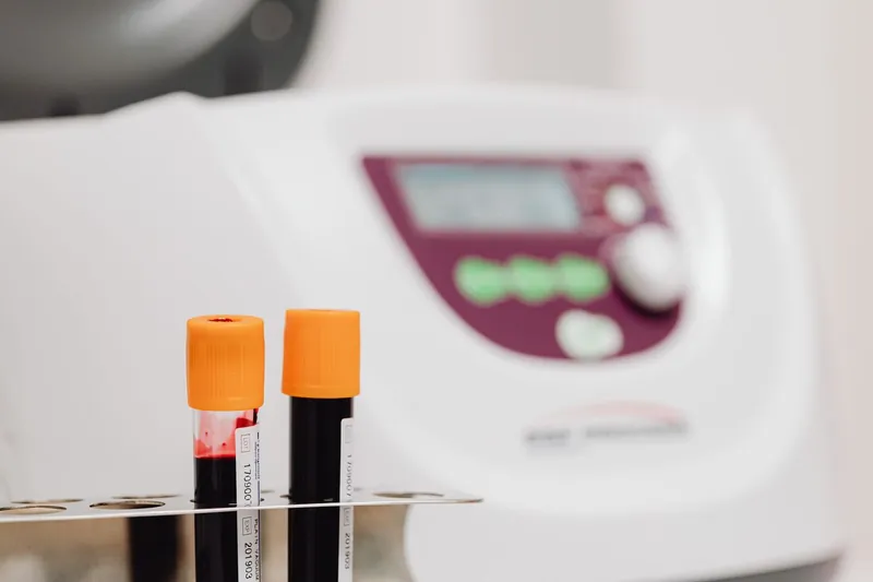 Tubos de coleta para exames laboratoriais